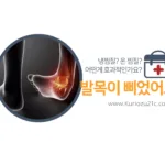 발목 삐었을 때 냉찜질